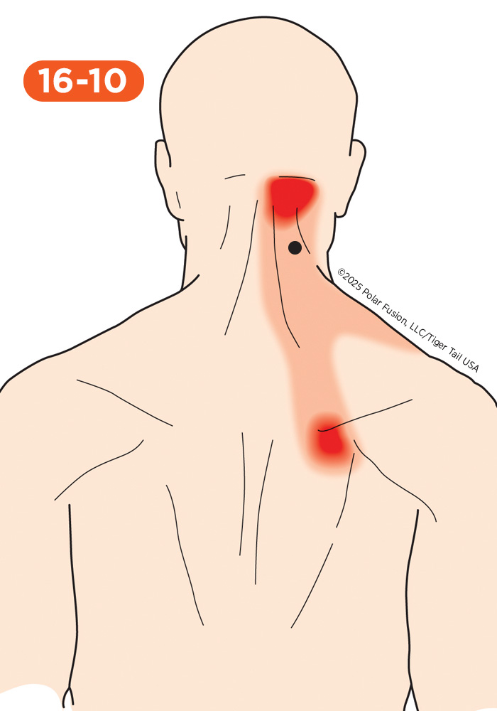 Shoulder Pain 16-10 Cervical Multifidi