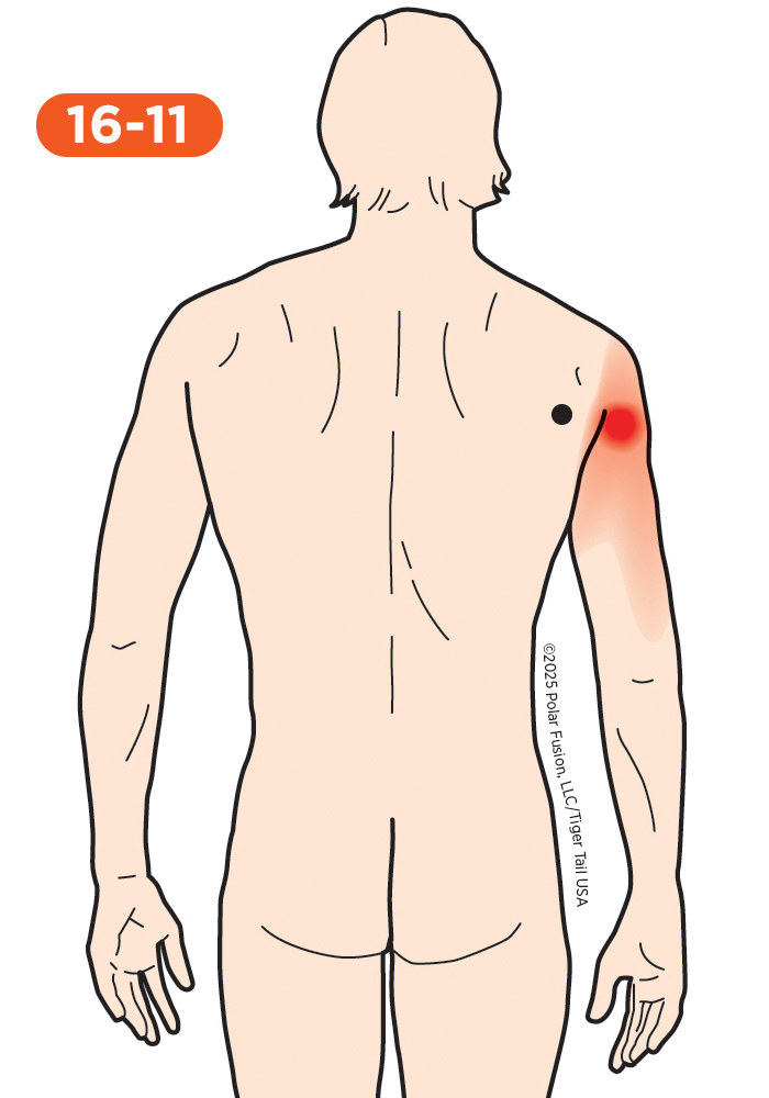 Shoulder Pain 16-11 Teres Minor