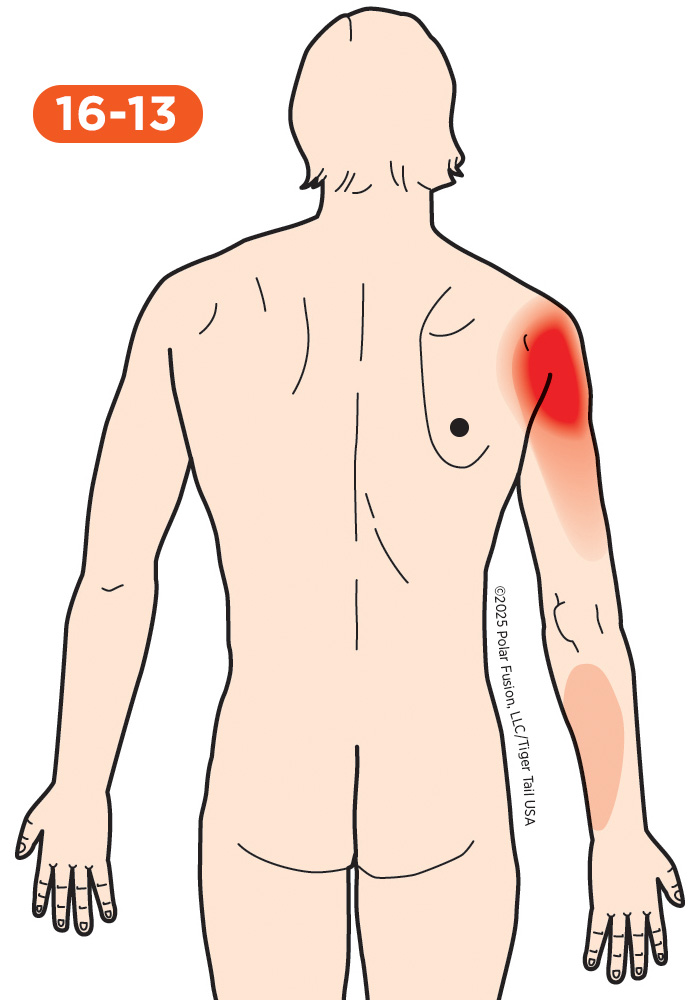 Shoulder Pain 16-13 Teres Major