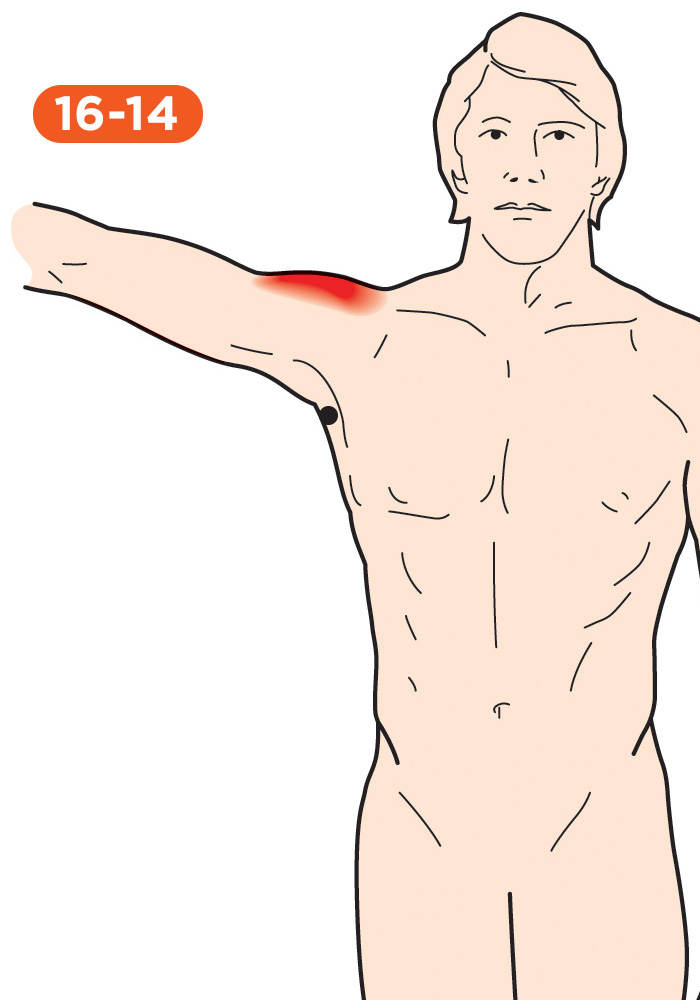 Shoulder Pain 16-14 Teres Major