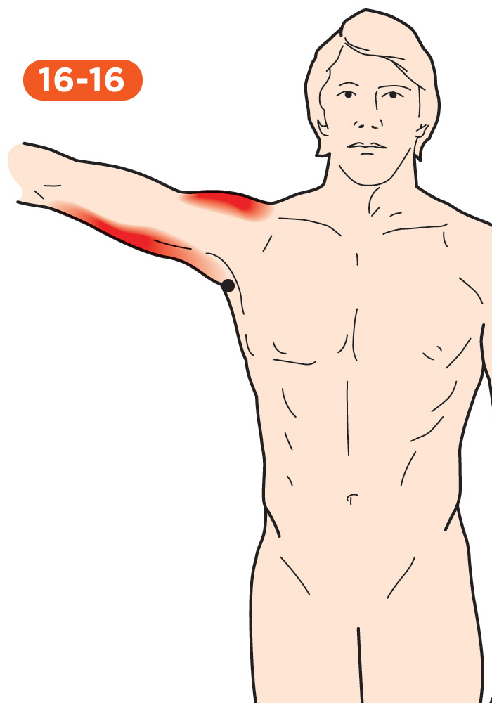 Shoulder Pain 16-16 Subscapularis