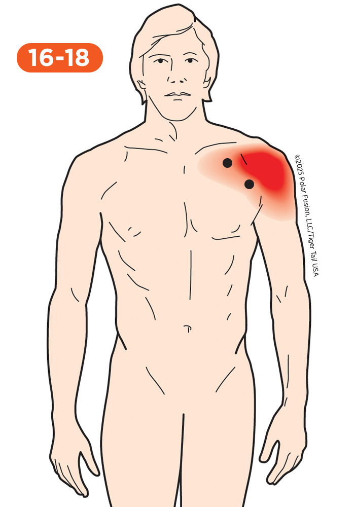 Shoulder Pain 16-18 Pectoralis Major Clavicular Section