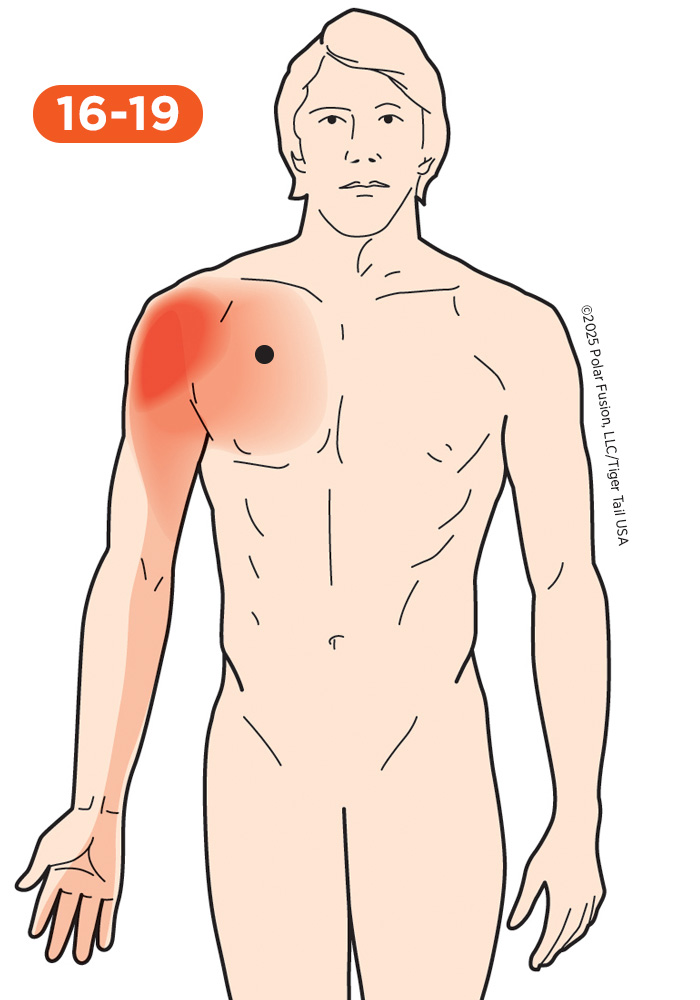 Shoulder Pain 16-19 Pectoralis Minor