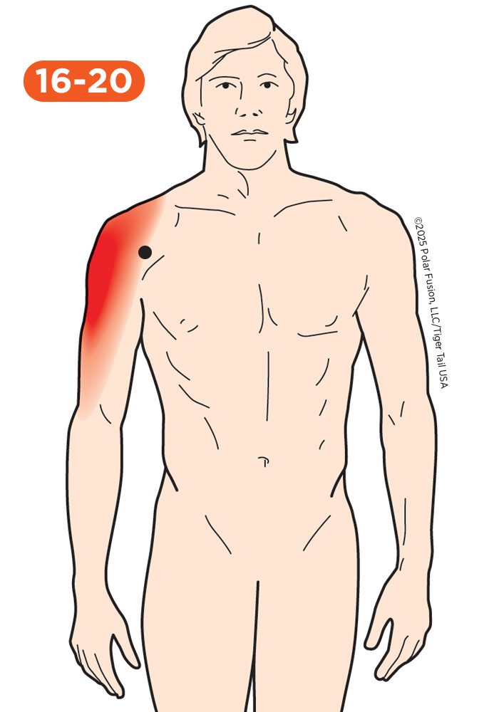 Shoulder Pain 16-20 Deltoid Anterior