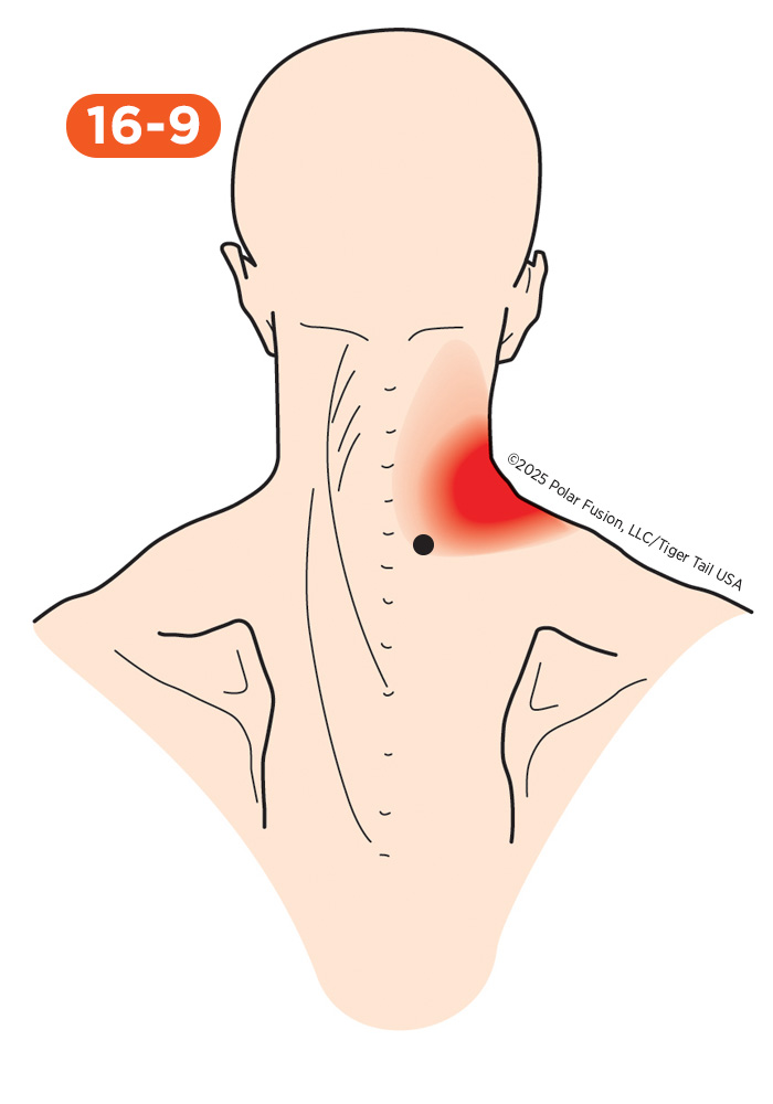 Shoulder Pain 16-9 Splenius Cervicis