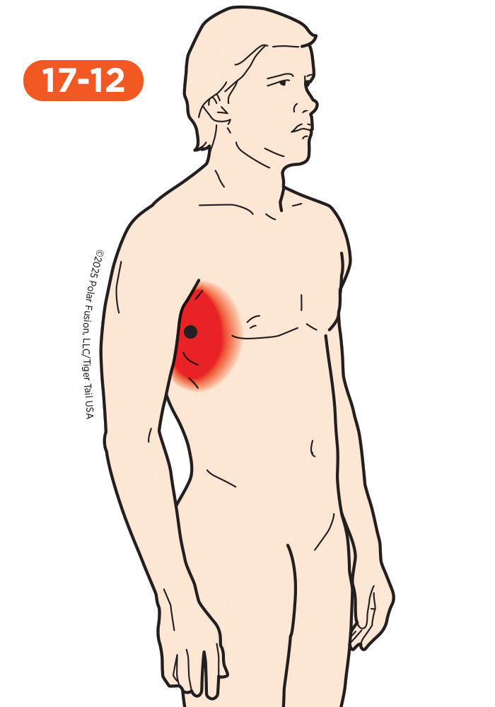 Forearm Pain 17-12 Serratus Anterior