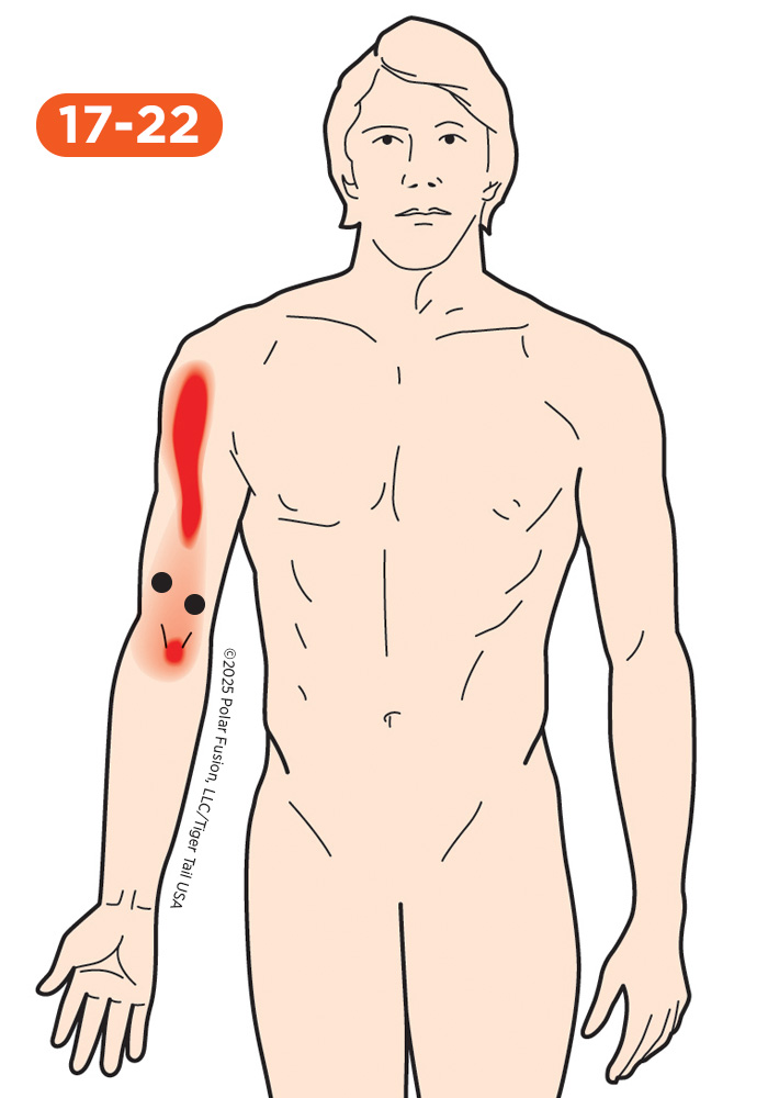 Upper Arm Pain 17-22 Biceps Brachii