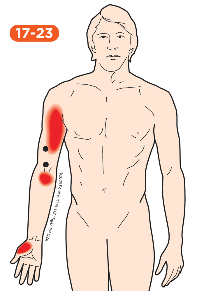Upper Arm Pain 17-23 Brachialis