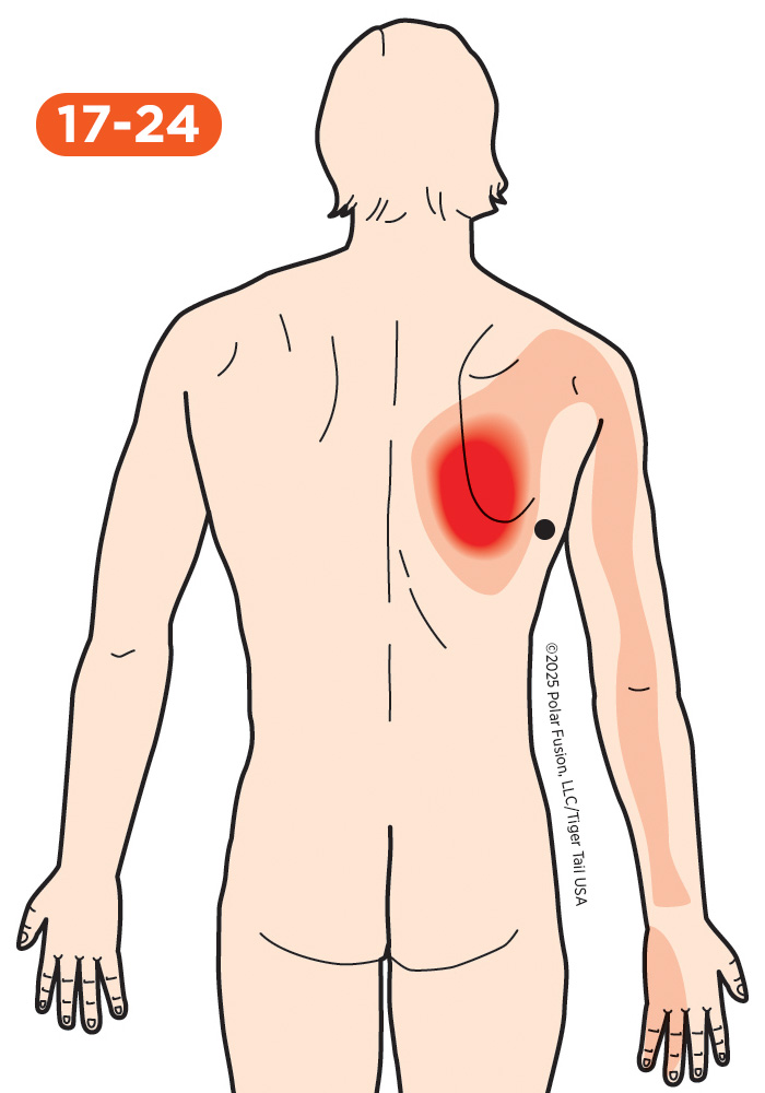 Upper Arm Pain 17-24 Latissimus Dorsi