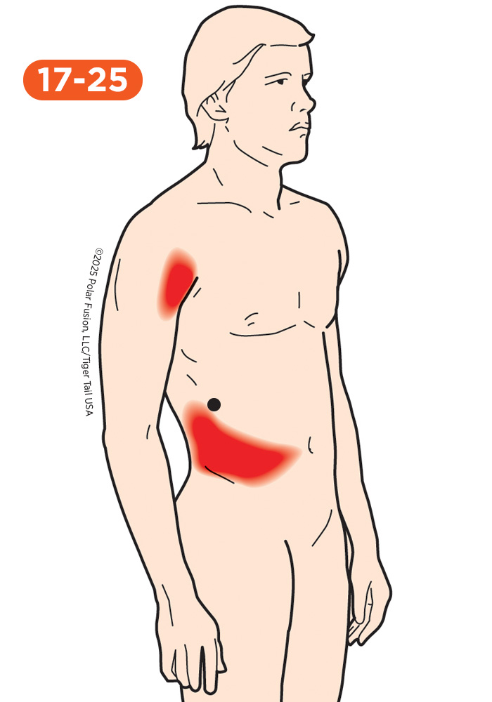 Upper Arm Pain 17-25 Latissimus Dorsi