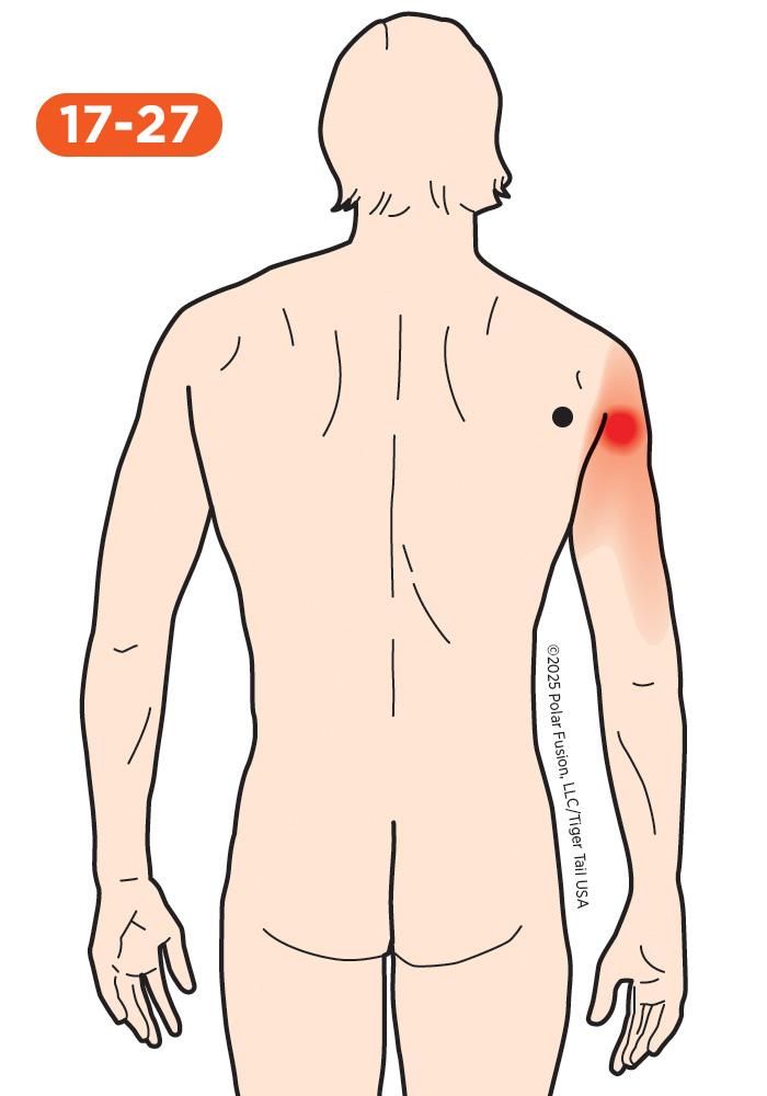 Upper Arm Pain 17-27 Teres Minor