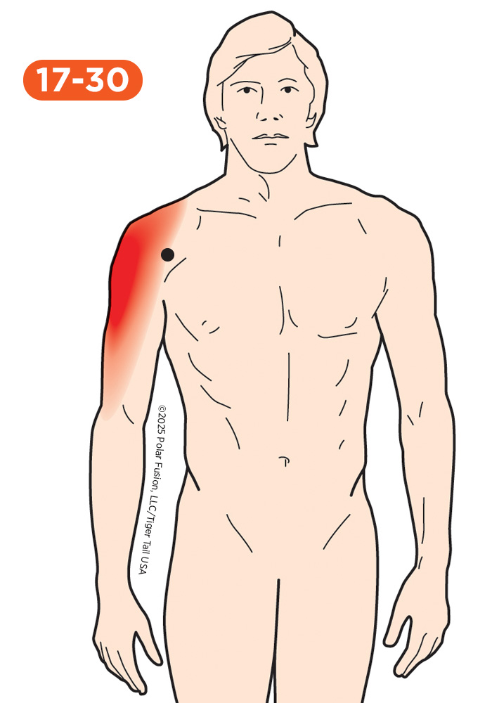 Upper Arm Pain 17-30 Deltoid