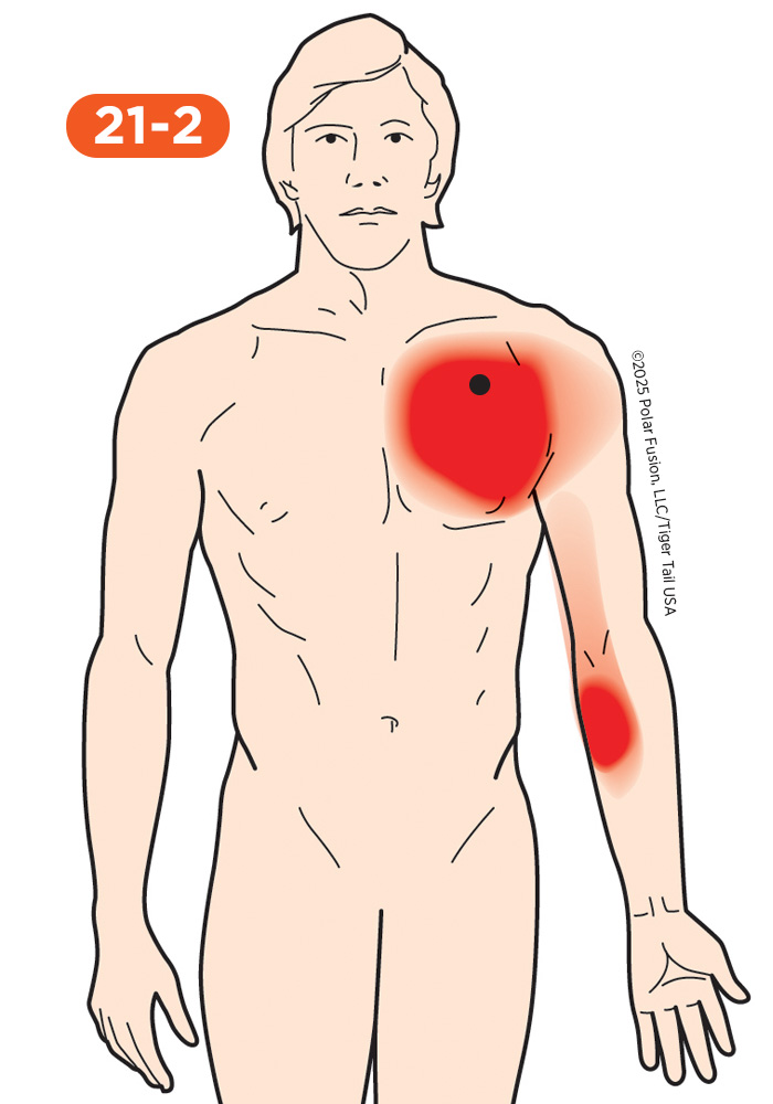 Chest Pain 21-2 Pectoralis Major Sternal Section