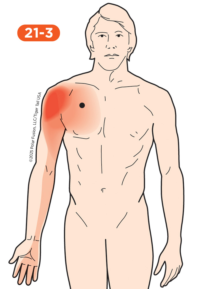 Chest Pain 21-3 Pectoralis Minor