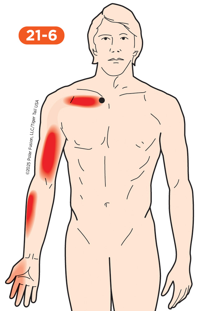 Chest Pain 21-6 Subclavius