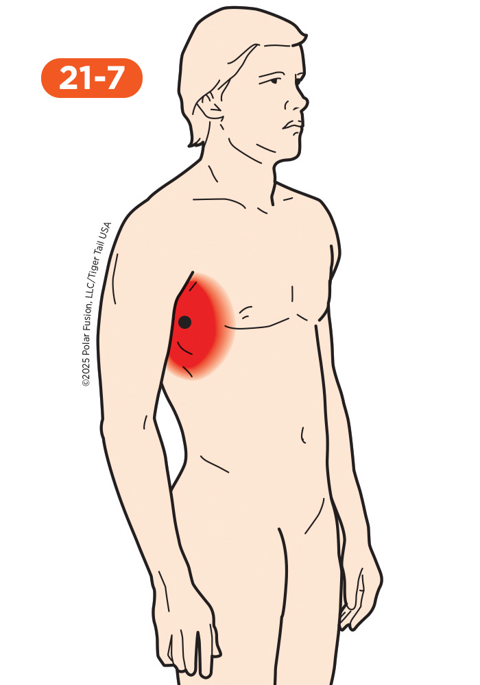 Chest Pain 21-7 Serratus Anterior