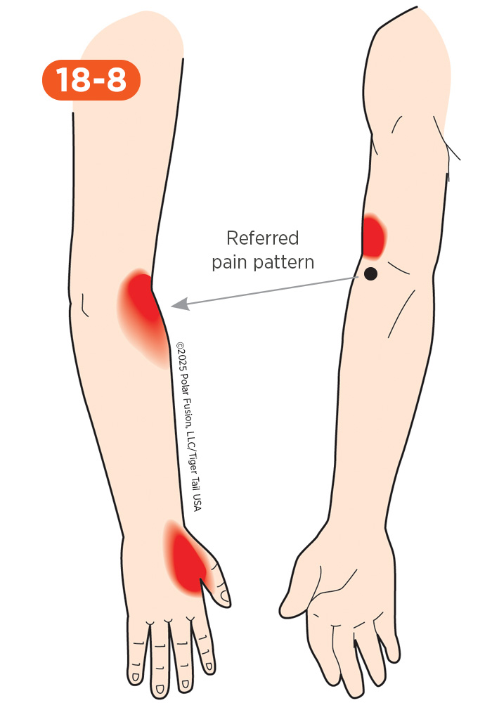 Elbow Pain 18-8 Supinator