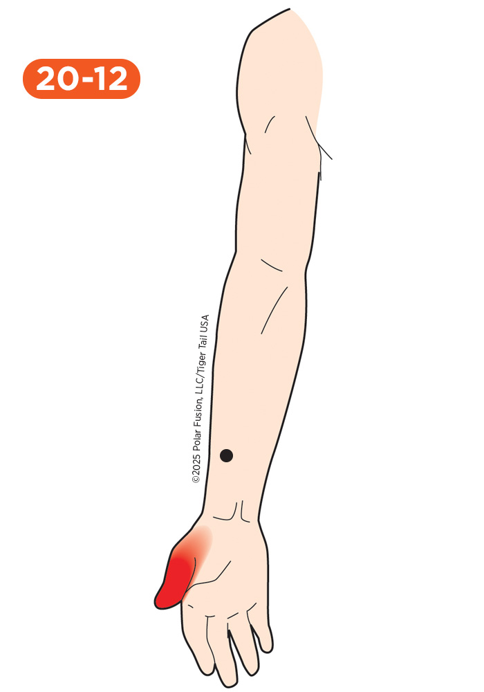 Hand Finger Thumb Pain 20-12 Flexor Pollicis Longus
