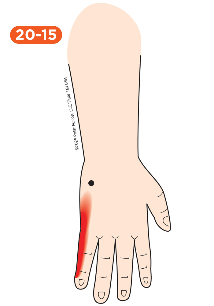 Hand Finger Thumb Pain 20-15 Abductor Digiti Minimi