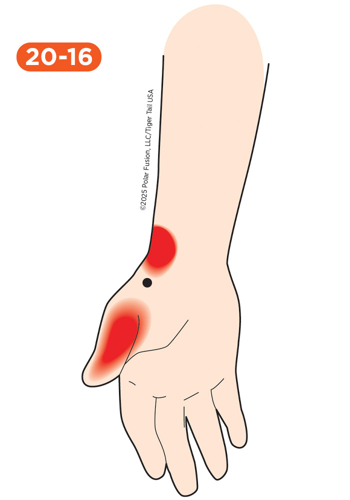 Hand Finger Thumb Pain 20-16 Opponens Pollicis