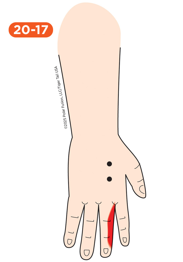 Hand Finger Thumb Pain 20-17 Second Dorsal Interosseous
