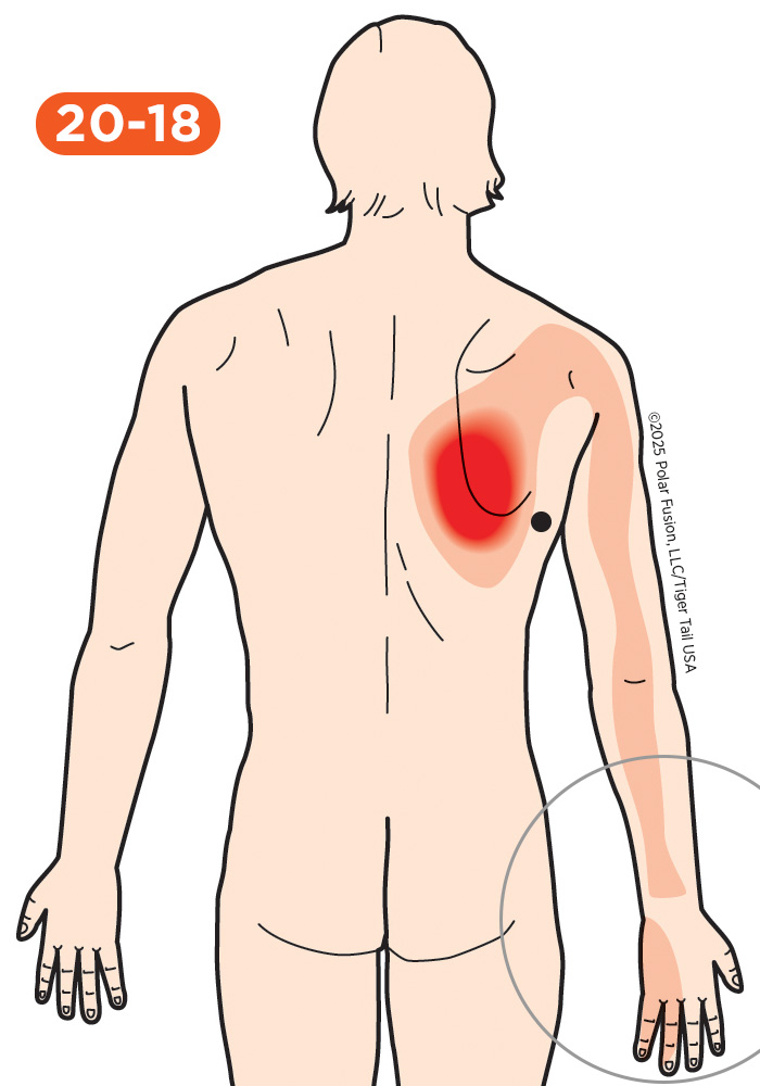 Hand Finger Thumb Pain 20-18 Latissimus Dorsi