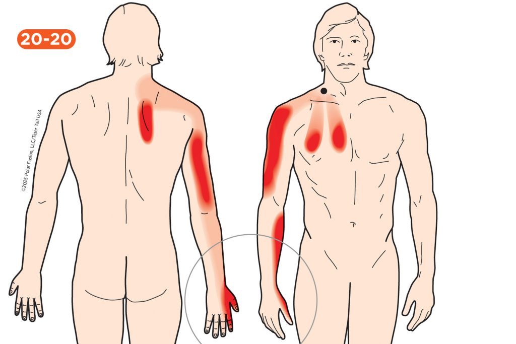 Hand Finger Thumb Pain 20-20_Scaleni