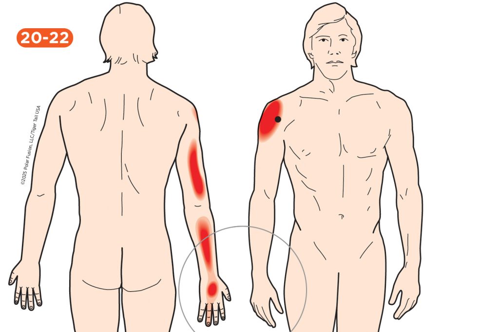 Hand Finger Thumb Pain 20-22 Coracobrachialis