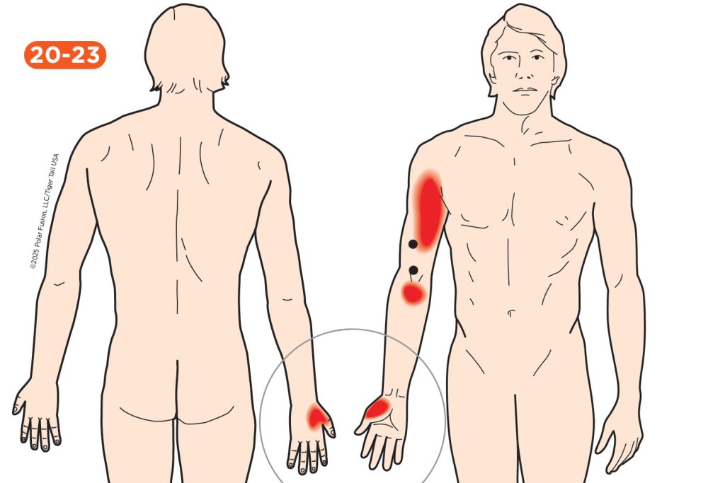 Hand Finger Thumb Pain 20-23 Brachialis