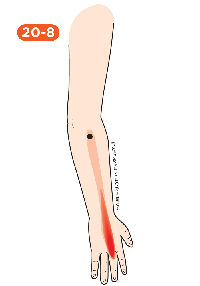 Hand Finger Thumb Pain 20-8 Middle Finger Extensor
