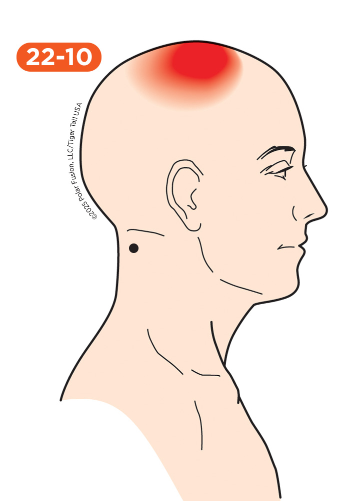 Head and Neck Pain 22-10 Splenius Capitis