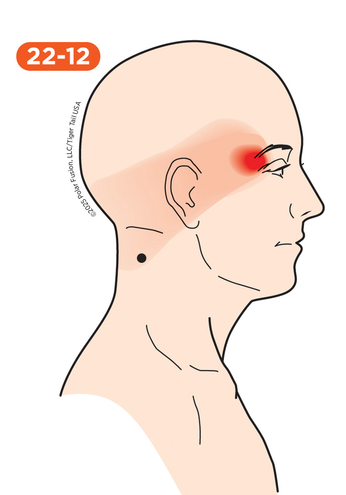 Head and Neck Pain 22-12 Upper Splenius Cervicis