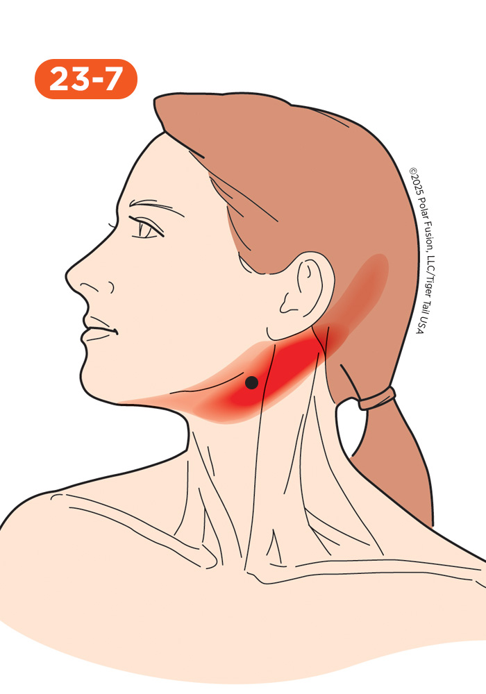 Jaw and Teeth Pain 23-7 Digastric Posterior