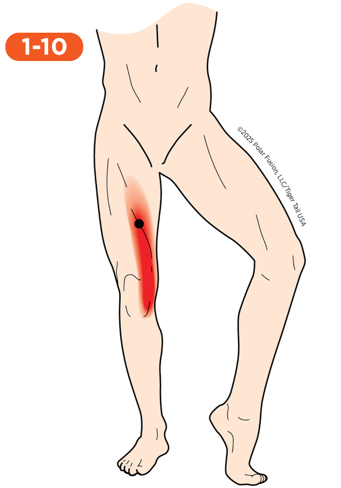 Knee Pain 1-10 Vastus Medialis Oblique