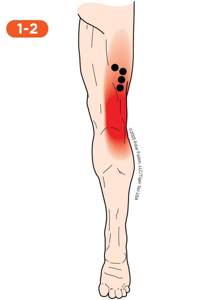 Knee Pain 1-2 Biceps Femoris