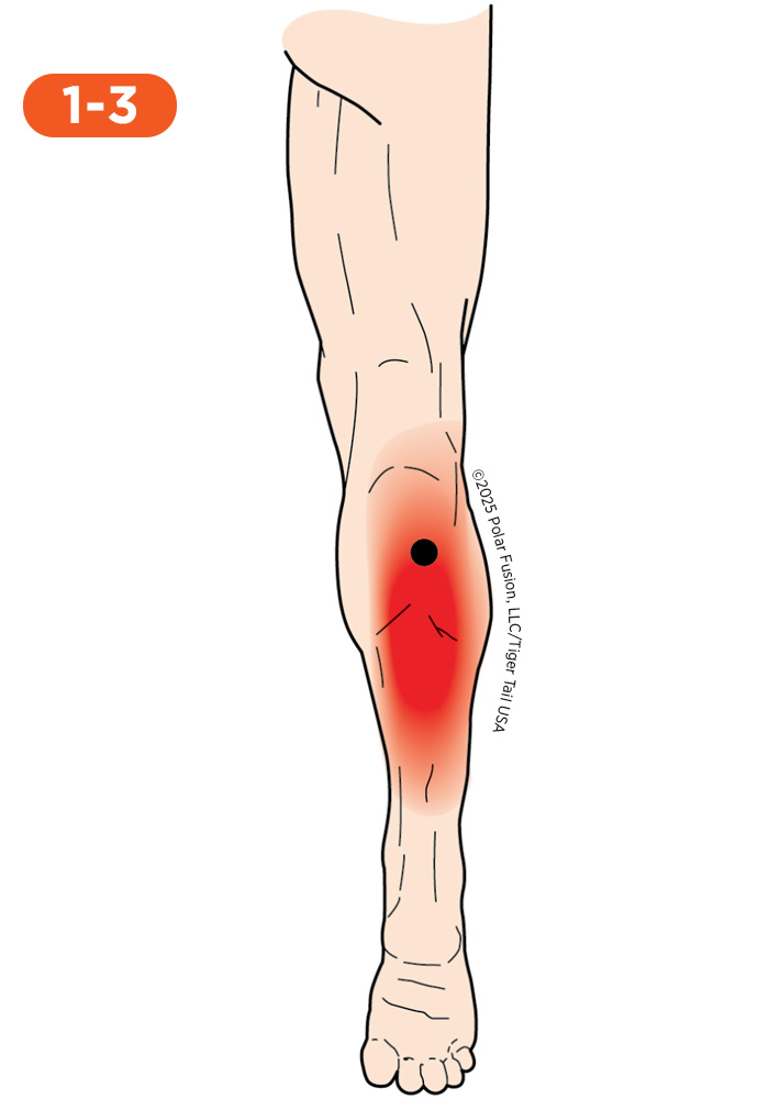 Knee Pain 1-3 Soleus