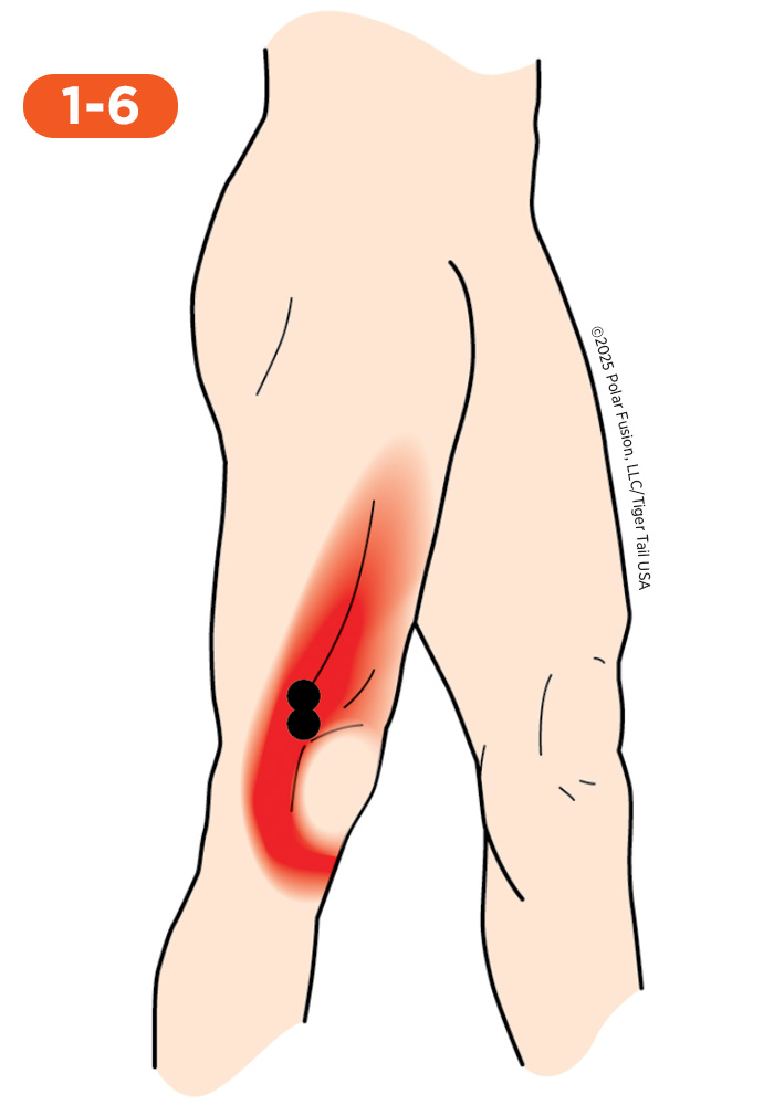 Knee Pain 1-6 Vastus Lateralis