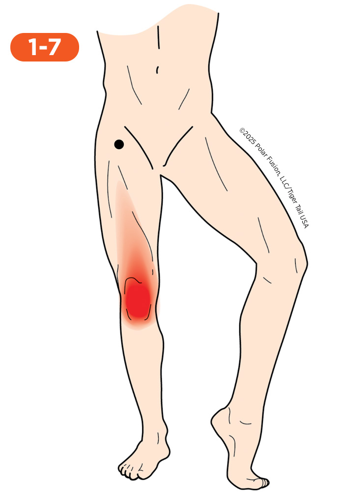 Knee Pain 1-7 Rectus Femoris