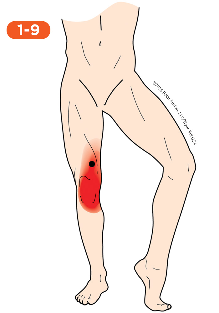 Knee Pain 1-9 Vastus Medialis Oblique