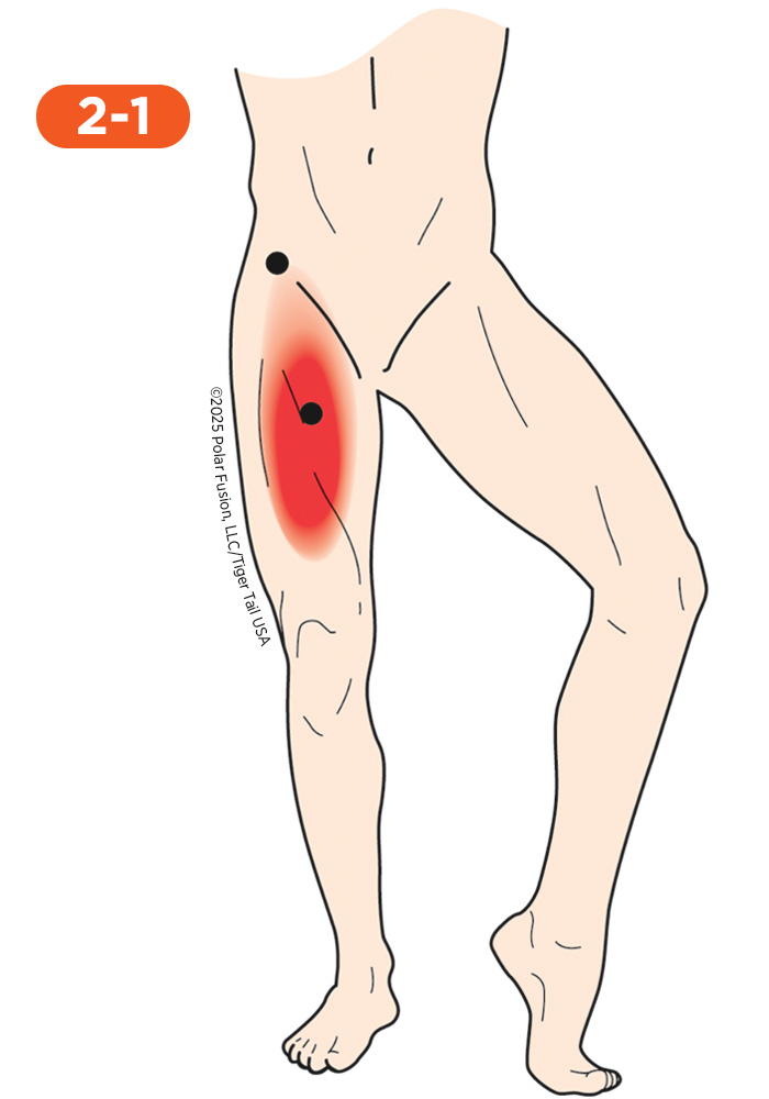 Quadriceps Pain 2-1 Iliopsoas